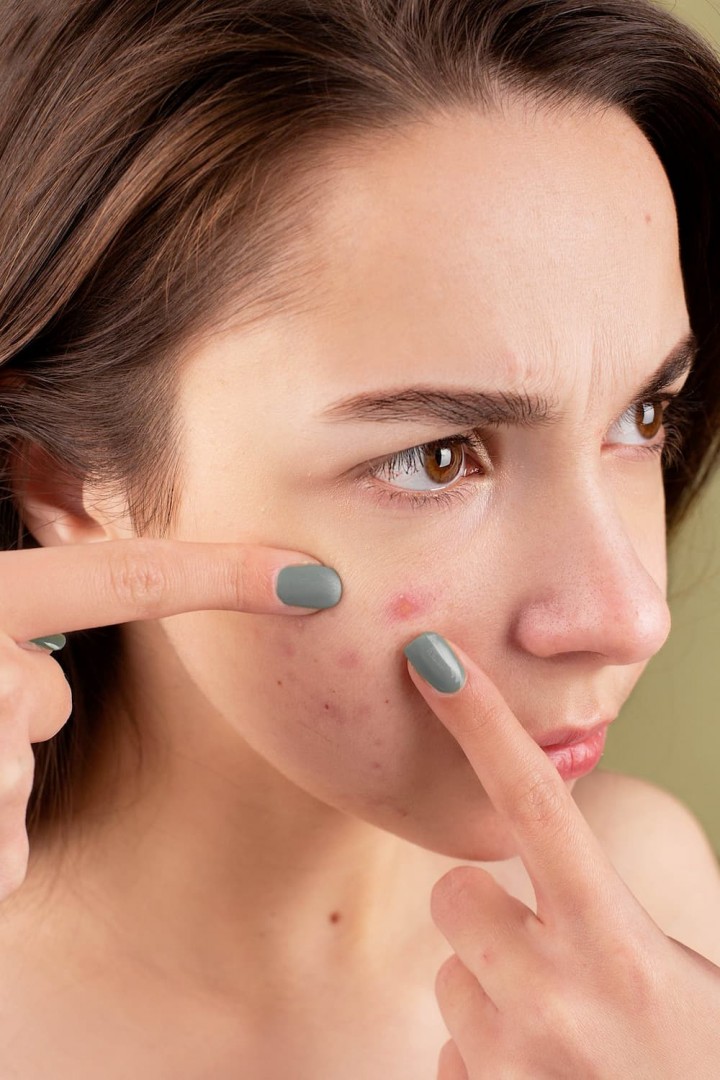 Stress & Beauty: How Does Stress Affect Your Skin?