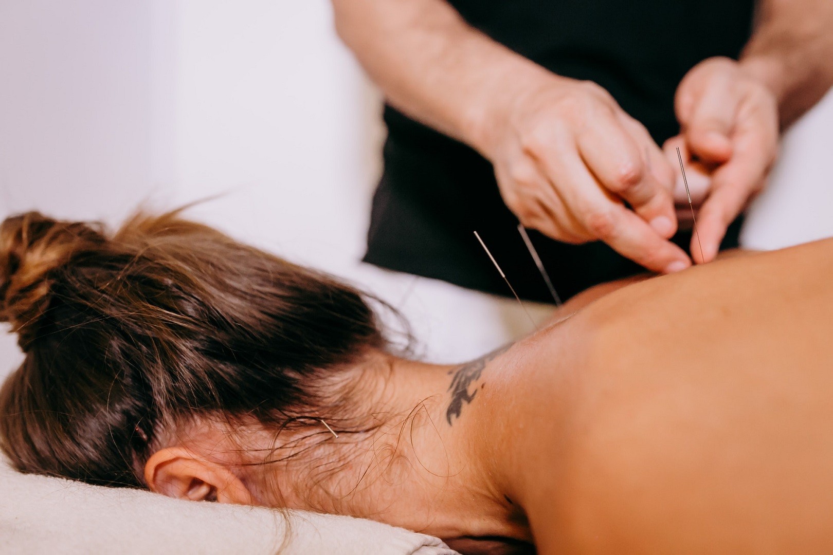 How to Become the Go-to Acupuncturist in Your Area