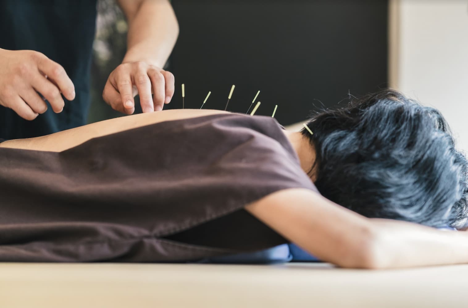 Acupuncture Courses in Perth