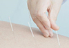 Adelaide Integrative Acupuncture therapist on Natural Therapy Pages