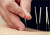 YUE XIU HUI Chinese Herbal Clinic therapist on Natural Therapy Pages