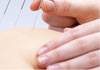 Perth Acupuncture and Pain Clinic therapist on Natural Therapy Pages