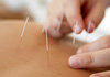 The Weston Acupuncture & Naturopathic Clinic therapist on Natural Therapy Pages