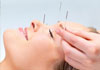 Yan Acupuncture Clinic therapist on Natural Therapy Pages