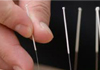 Wise Acupuncture therapist on Natural Therapy Pages