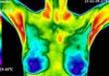 Gold Coast Thermal Imaging therapist on Natural Therapy Pages