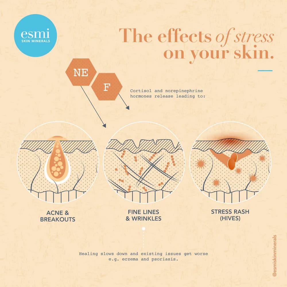 How stress affects your skin