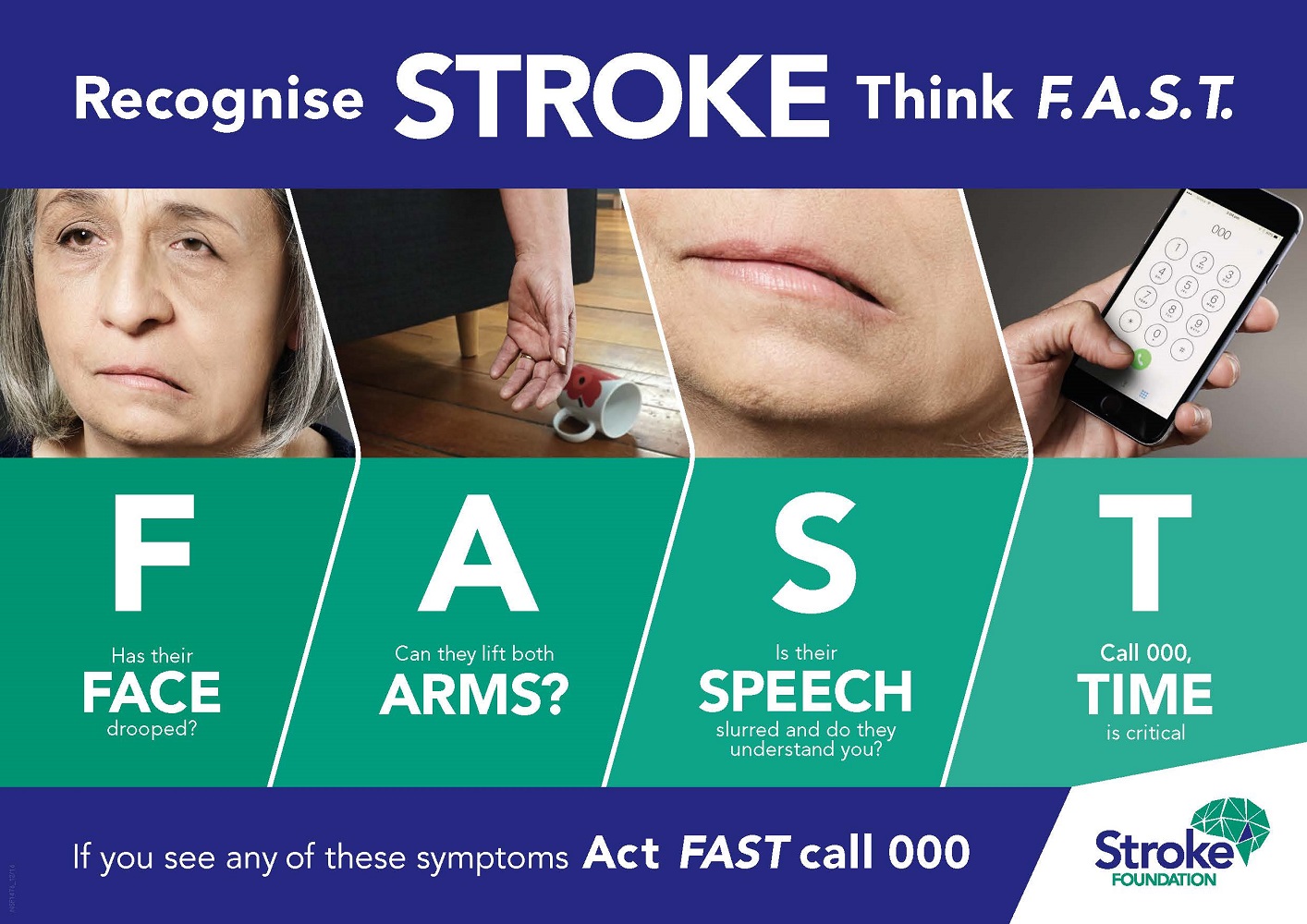 National Stroke Week 2019