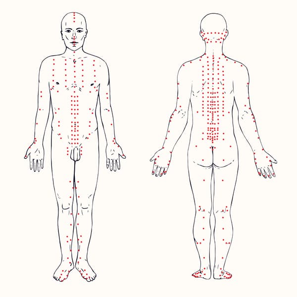 Acupuncture points in the human body for weight loss