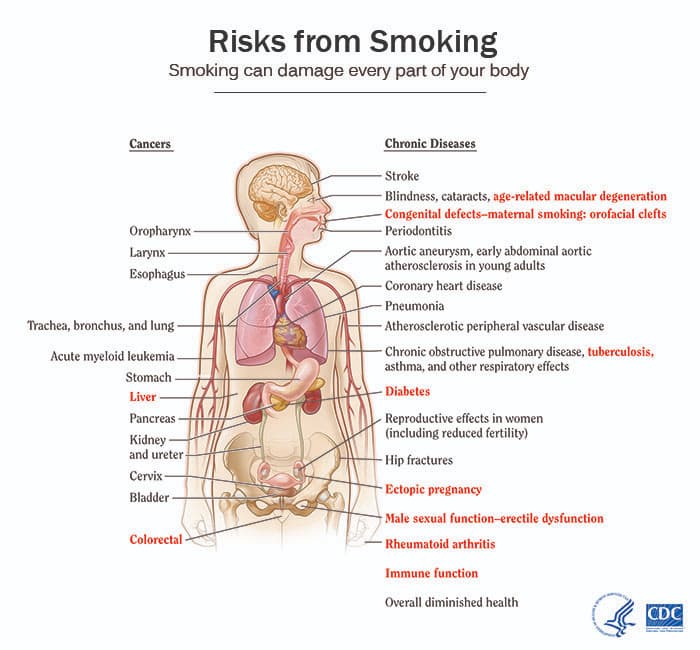 Health effects of smoking
